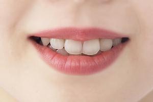 蒙古斑が気になる人にはレーザー治療を