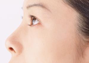 【2025年最新版】アザに効果的なレーザー治療の全て：安心・安全な対策と最新技術を徹底解説